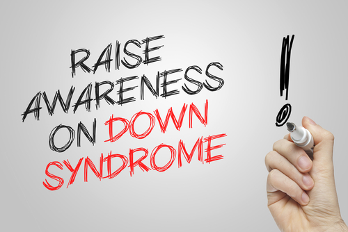 downsyndrome1