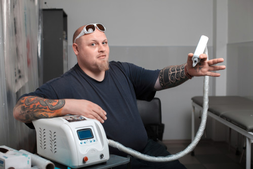 tattoo removal machine