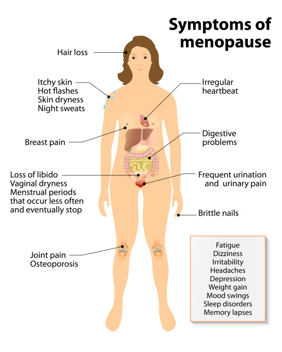 menopause symptoms